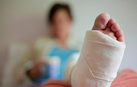 Woman with a broken leg
