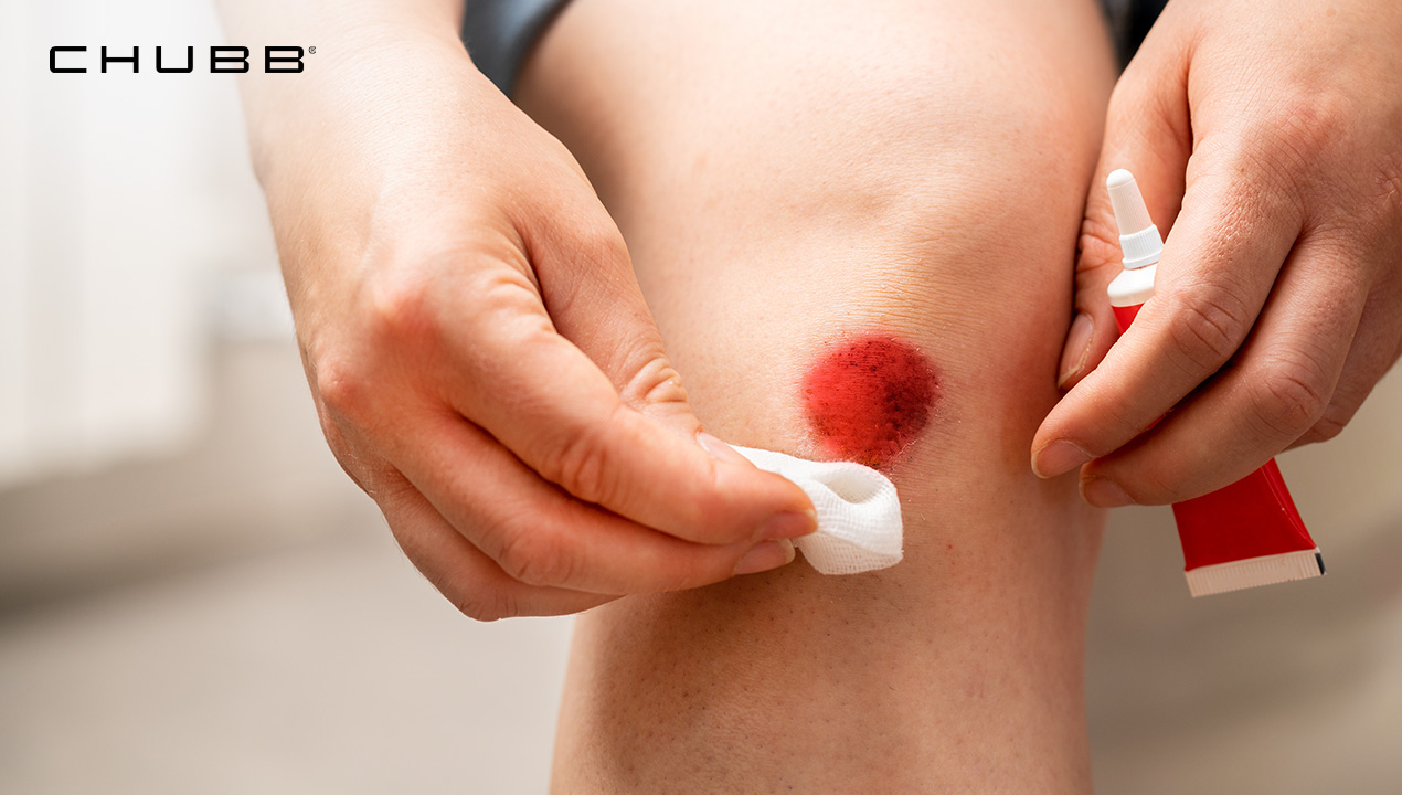 มอเตอร์ไซค์ล้ม วิธีปฐมพยาบาล